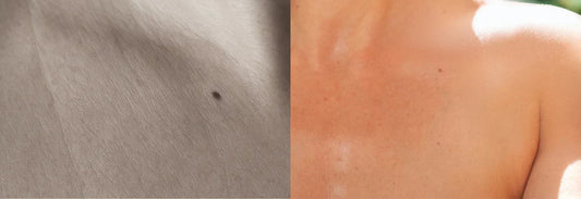 Pourquoi la peau morte vous fait vieillir ? Et comment l'exfoliation peut aider..